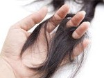 Ayurvedic Hair Loss Medicine