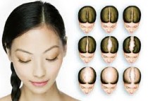 Hair Loss Treatment