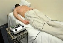 ElectroAcupuncture