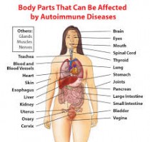 AUTO IMMUNE DISORDER