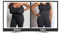 Female Breast Reduction