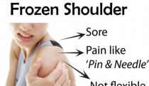 Frozen Shoulder