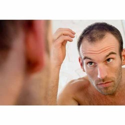 Herbal Hair Loss Product