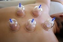 Cupping