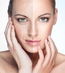 Skin Rejuvenation