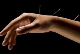 Acupuncture Treatment