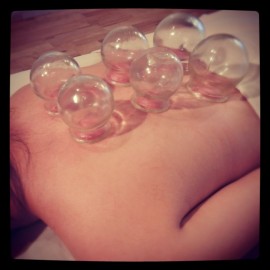 CUPPING THERAPY