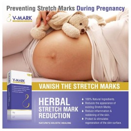 V-Mark Anti Stretch Mark Cream