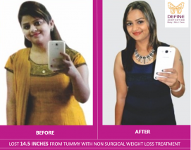 Weight Loss Treatment In Pune