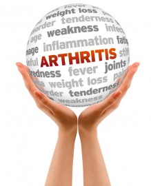 Arthritis