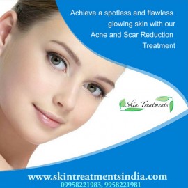 Acne Scar Reduction Treatment