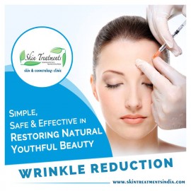 Wrinkle Reduction Treatment