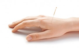 Acupunture Therapy