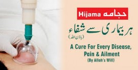 Hijama