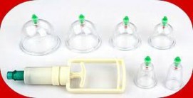 Hijama