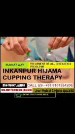 Hijama Cupping Therapy