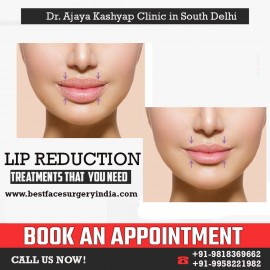 Lip Reduction Surgery