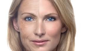 Anti Aging Treatment