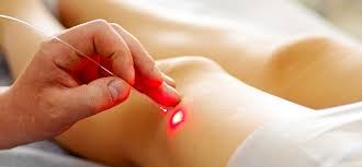 Laser Therapy