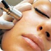 Microdermabrasion Treatment