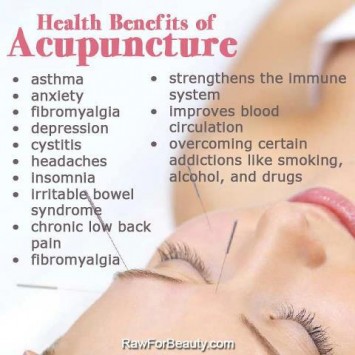 ACUPUNCTURE TREATMENT