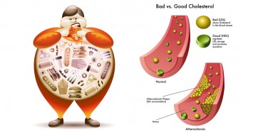 Cholestrol