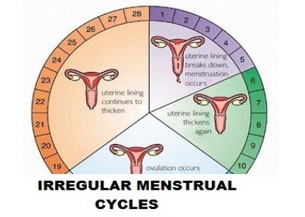 Irregular Menstrual Cycles