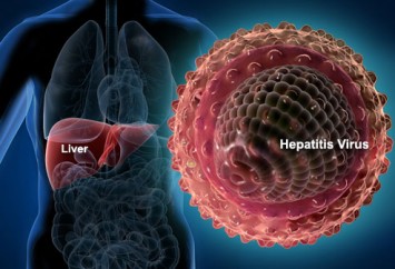 Hepatitis B