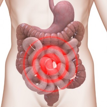 Irritable Bowel Syndrome Treatment