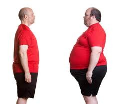 Obesity Treatment