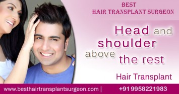 Hair Transplant Surgery Delhi, India