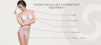 ThermiTight Treatment