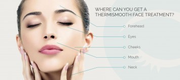 ThermiSmooth Face Treatment