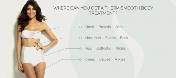 ThermiSmooth Body Treatment