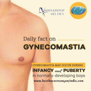 Gynecomastia Surgery in Delhi, India