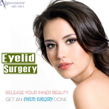 Eyelid Surgery in Delhi