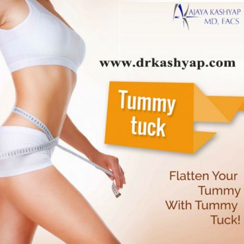 Tummy Tuck Surgery in Delhi