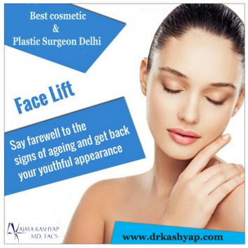 Face Lift Surgery in Delhi