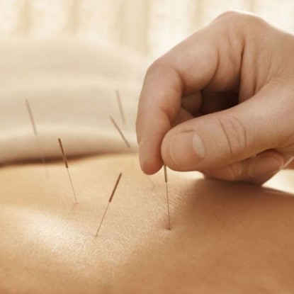  Acupuncture Doctor Service Provider from Delhi